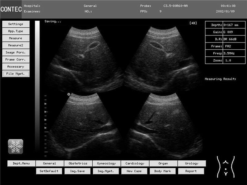 Portable Digital Laptop Ultrasound Scanner Diagnostic Machine,Convex/abdominal DIAGNOSTIC ULTRASOUND MACHINES FOR SALE