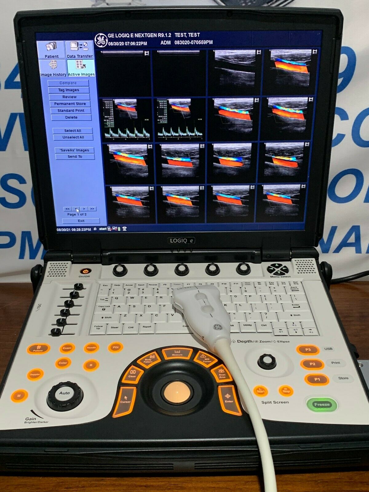 GE LOGIQ E NEXTGEN ULTRASOUND R.9.1.2 WITH 1 PROBE INCLUDED ALL OPTIONS ENABLED DIAGNOSTIC ULTRASOUND MACHINES FOR SALE