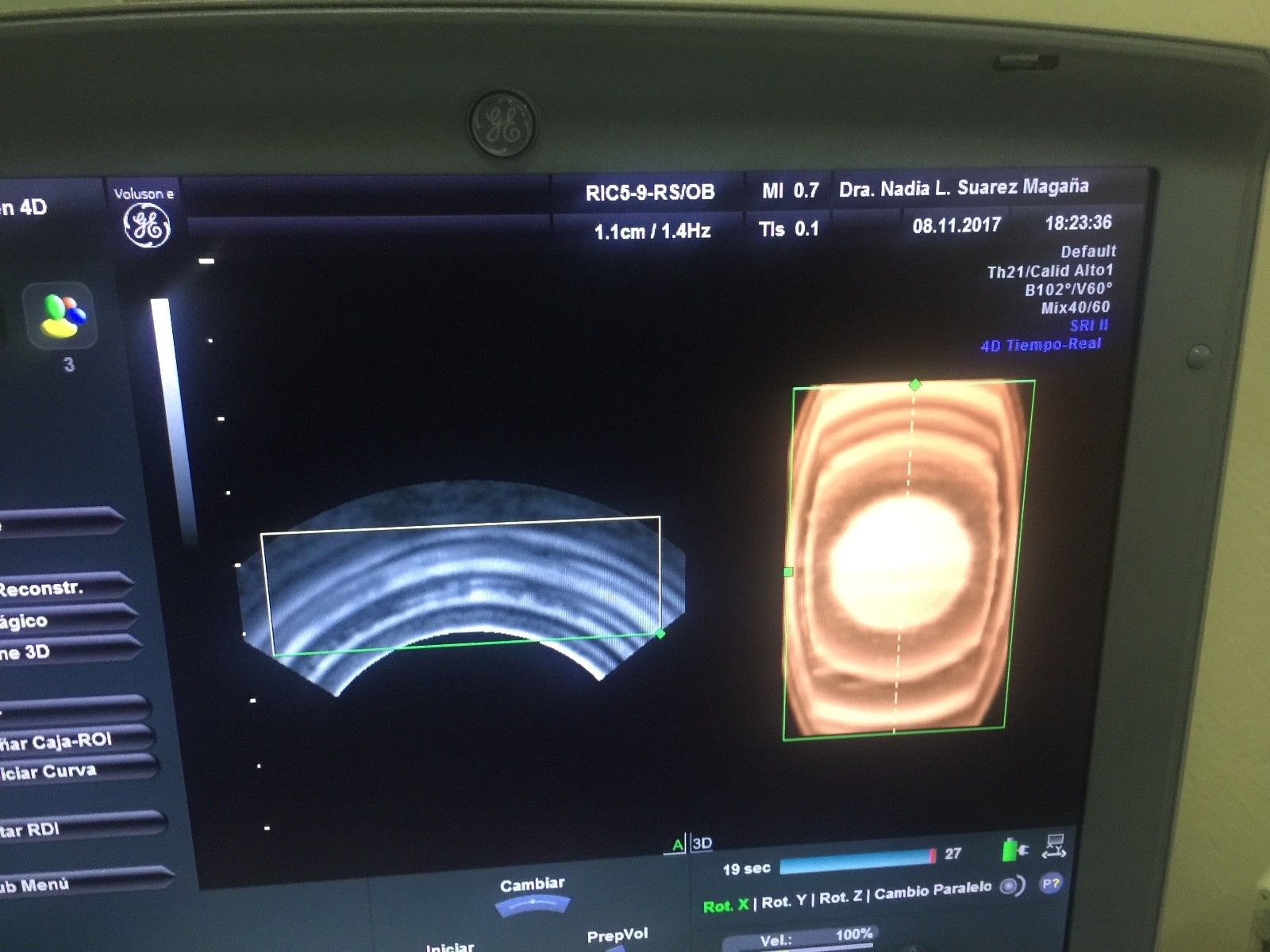 GE RIC5-9-RS 4D ENDOCAVITY PROBE FOR VOLUSON i/e DIAGNOSTIC ULTRASOUND MACHINES FOR SALE