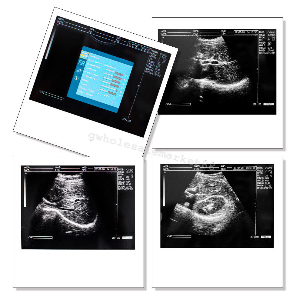 Portable Ultrasound Machine Scanner System Convex probe 3D Software Best Image 190891045898 DIAGNOSTIC ULTRASOUND MACHINES FOR SALE
