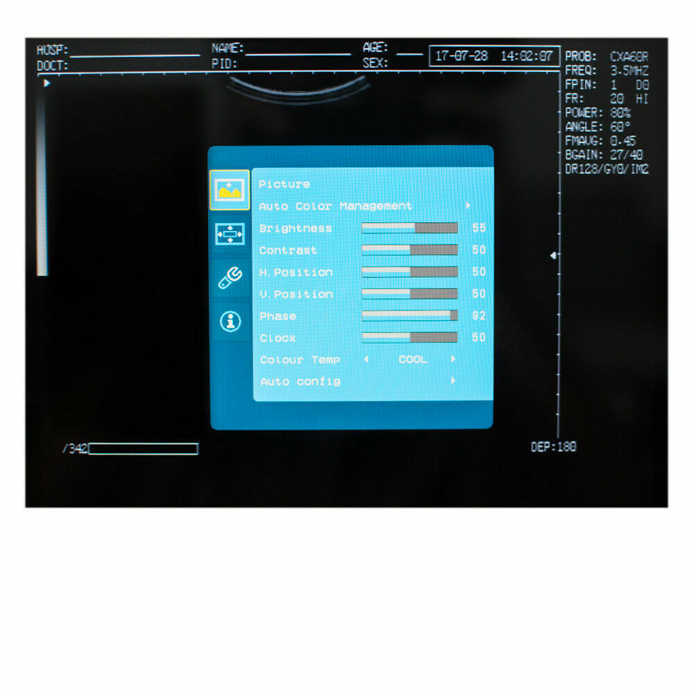 Portable Medical Laptop Diagnostic Ultrasound Scanner 3.5 Convex probe+Free 3D DIAGNOSTIC ULTRASOUND MACHINES FOR SALE
