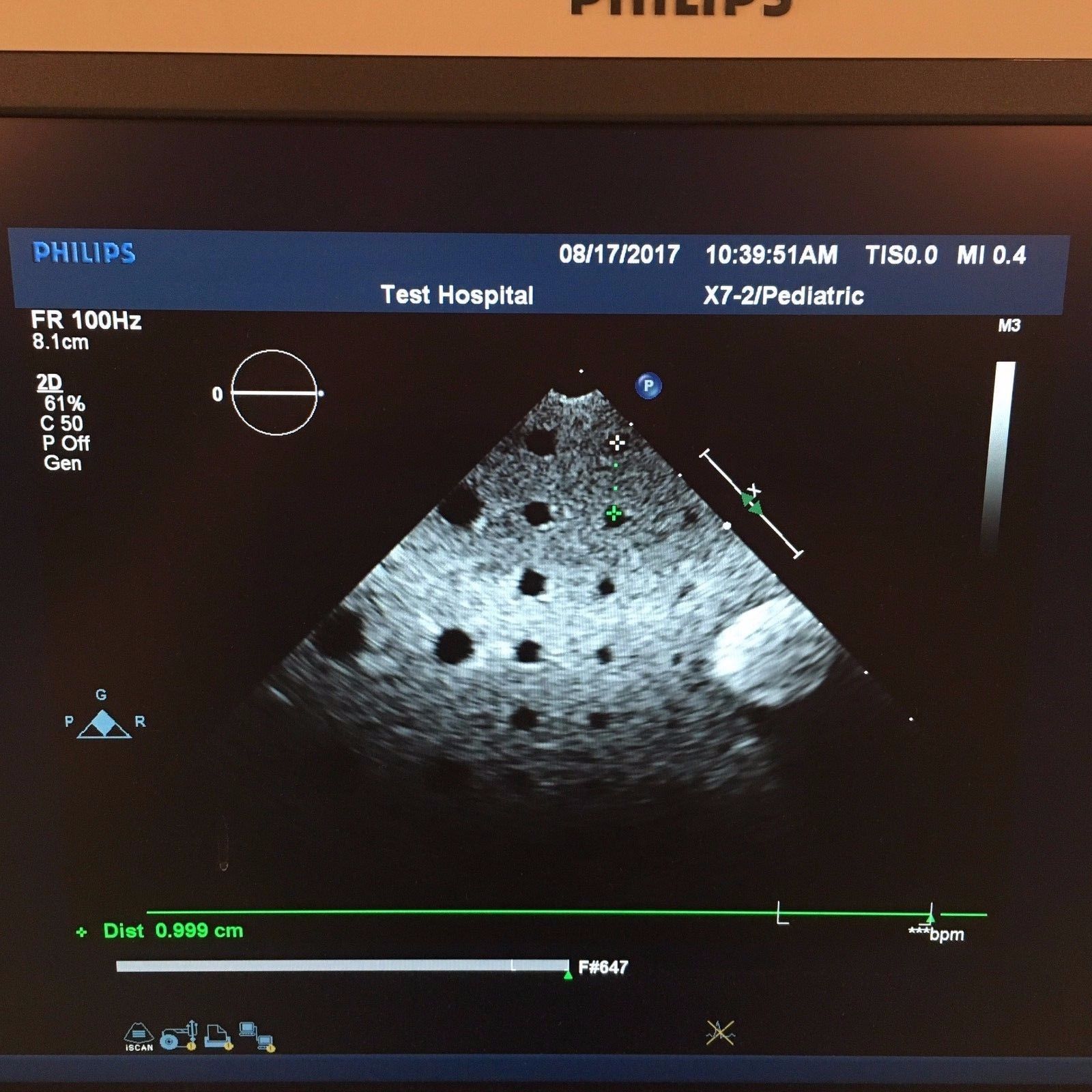 Philips X7-2 Ultrasound Probe