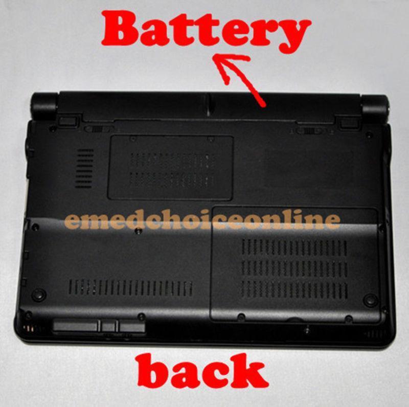 External 3D Software Medical Digital Laptop Ultrasound Scanner Scan Linear Probe 190891735522 DIAGNOSTIC ULTRASOUND MACHINES FOR SALE