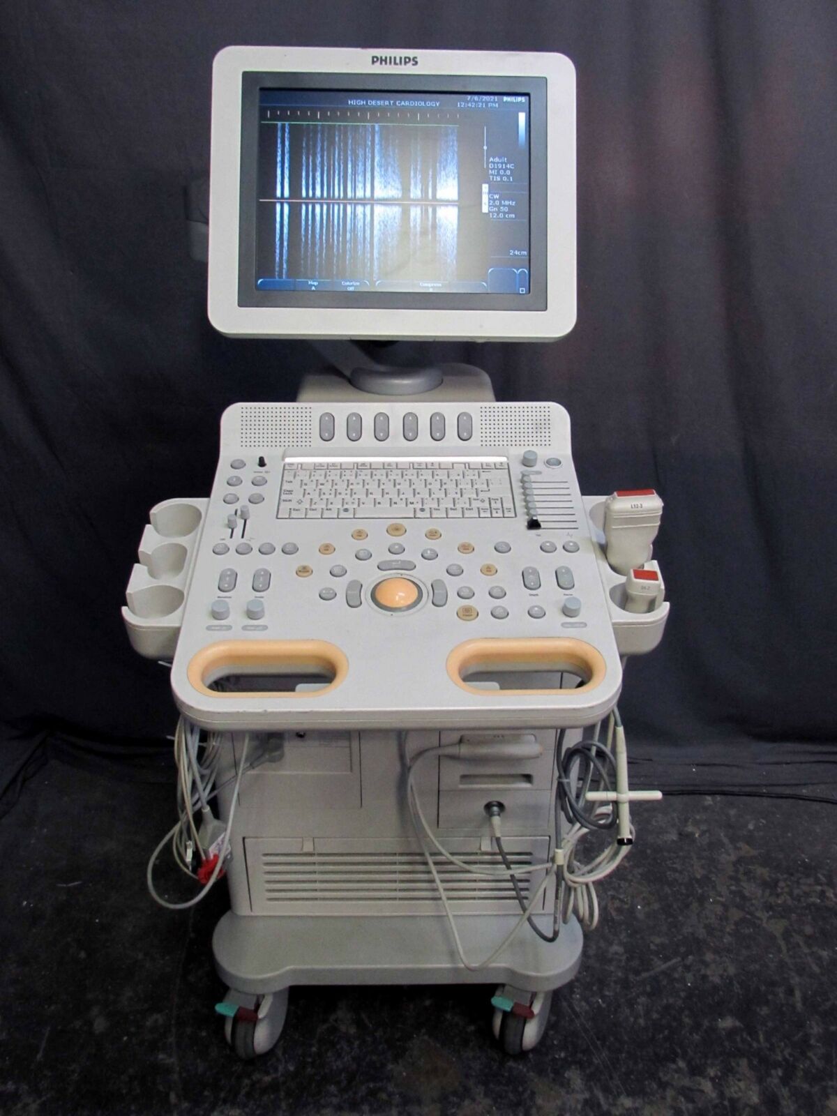 Philips HD7XE Diagnostic Ultrasound System with 2 Transducers & Doppler Probe DIAGNOSTIC ULTRASOUND MACHINES FOR SALE