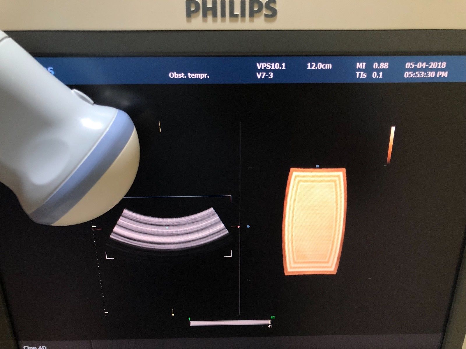 PHILIPS V7-3 4D CONVEX PROBE FOR HD9 DIAGNOSTIC ULTRASOUND MACHINES FOR SALE