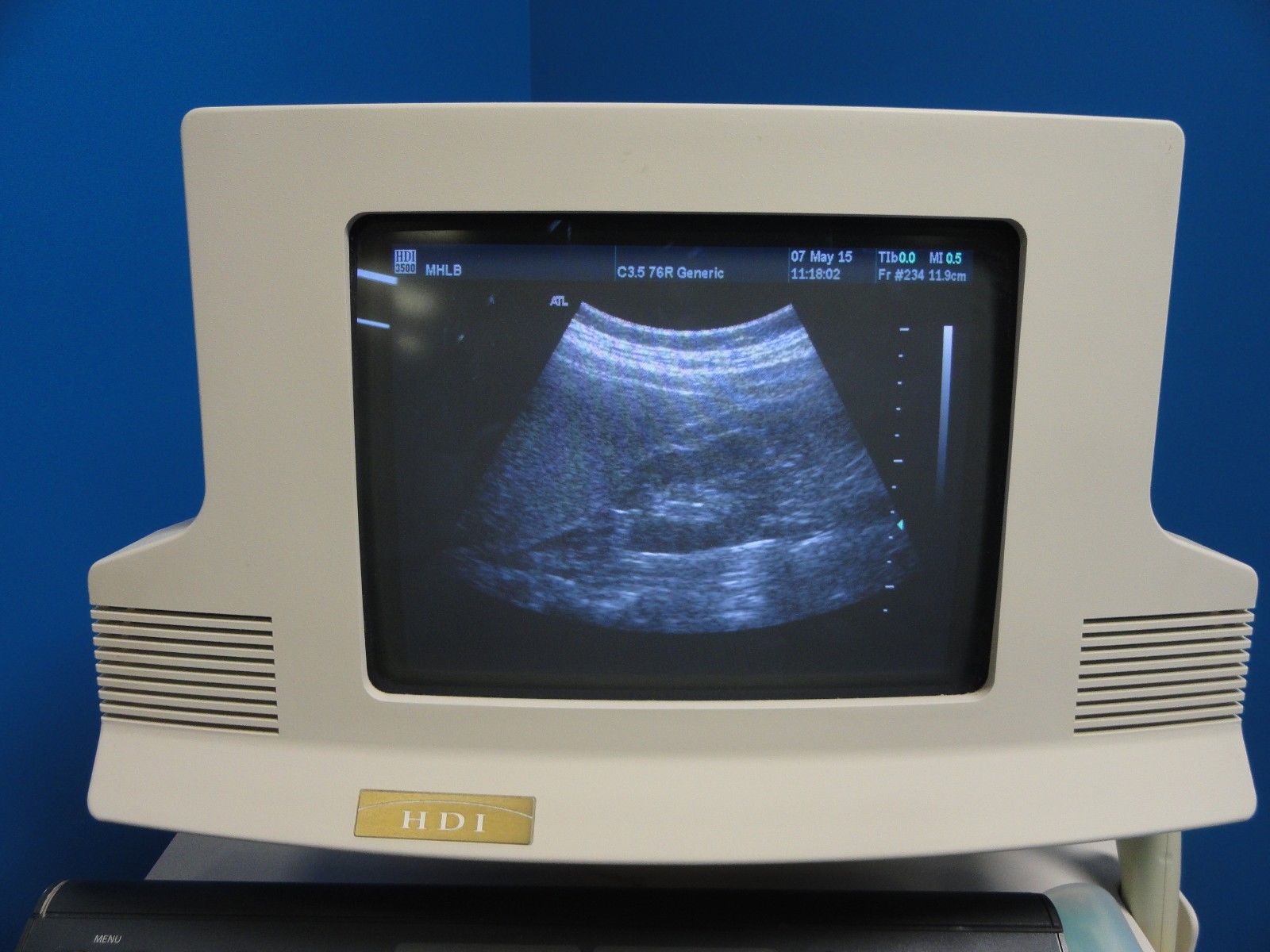 Philips ATL C3.5 76R  Convex / Curved Array Ultrasound Transducer Probe (8837) DIAGNOSTIC ULTRASOUND MACHINES FOR SALE