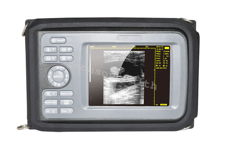Handheld Digital Color LCD Ultrasound Scanner+7.5Mhz HF linear Probe For Mankind DIAGNOSTIC ULTRASOUND MACHINES FOR SALE