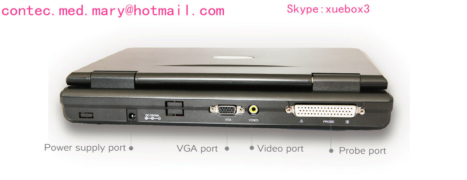 Portable laptop machine, Digital Ultrasound scanner, 3.5M Convex probe,US FedEx  658126883672 DIAGNOSTIC ULTRASOUND MACHINES FOR SALE