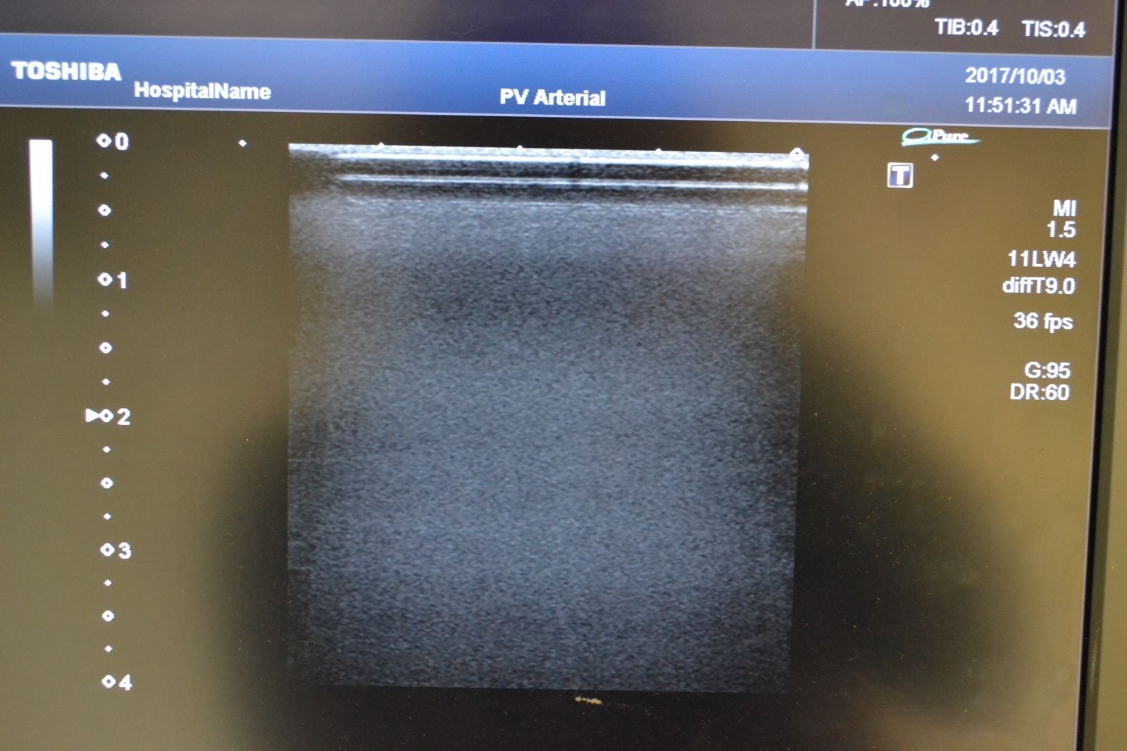 Toshiba Artida PLT-704SBT 11-4.8MHz Linear Ultrasound Transducer Probe  J1628 DIAGNOSTIC ULTRASOUND MACHINES FOR SALE