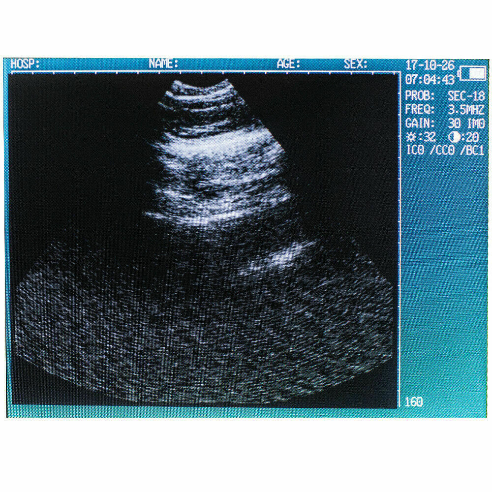 Portable Veterinary Vet Ultrasound Scanner Machine Kit For Pregnancy Animal Dog DIAGNOSTIC ULTRASOUND MACHINES FOR SALE