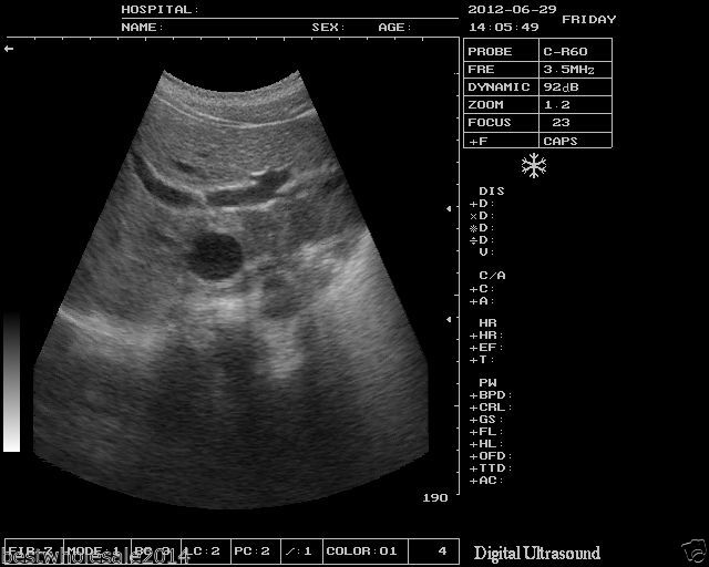 Medical Ultrasound Scanner/Machine 5.0 Micro-convex Array Probe Factory SEll CE* 190891843524 DIAGNOSTIC ULTRASOUND MACHINES FOR SALE