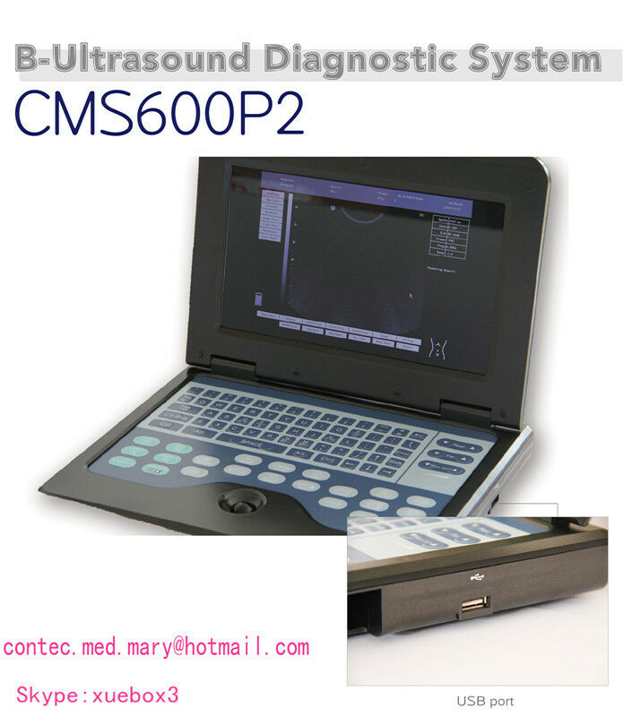 Portable laptop Digital Ultrasound scanner,pregnancy,Abdominal probe US seller 6945040100362 DIAGNOSTIC ULTRASOUND MACHINES FOR SALE