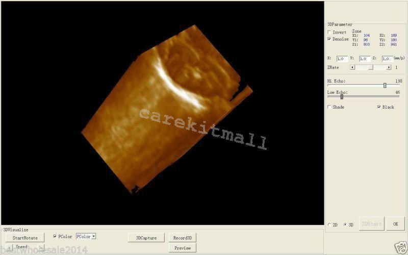 Portable Laptop Digital LCD Testor Ultrasound scanner with Transvaginal Probe CE 190891495471 DIAGNOSTIC ULTRASOUND MACHINES FOR SALE