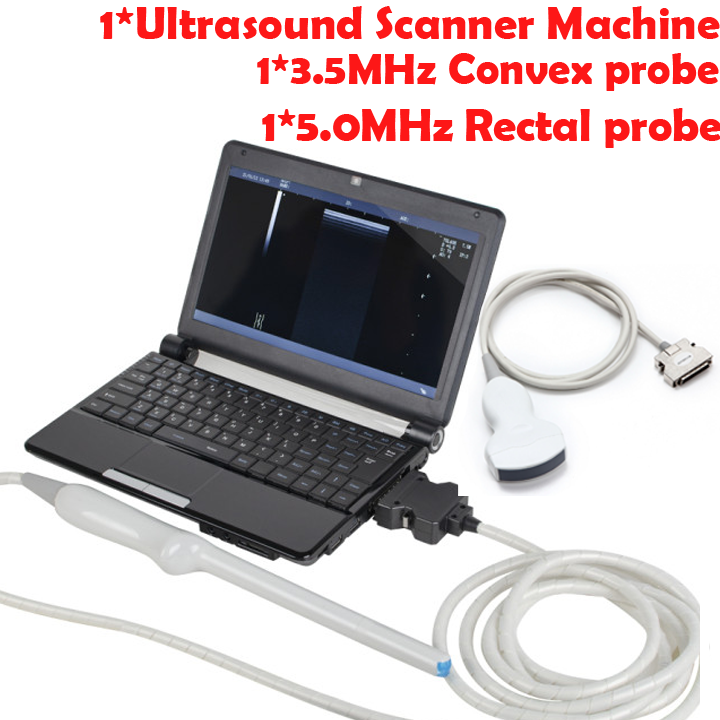 Laptop Machine Ultrasound Scanner 7.5MHz Linear Array Probe&Cavity Probe Safe DIAGNOSTIC ULTRASOUND MACHINES FOR SALE