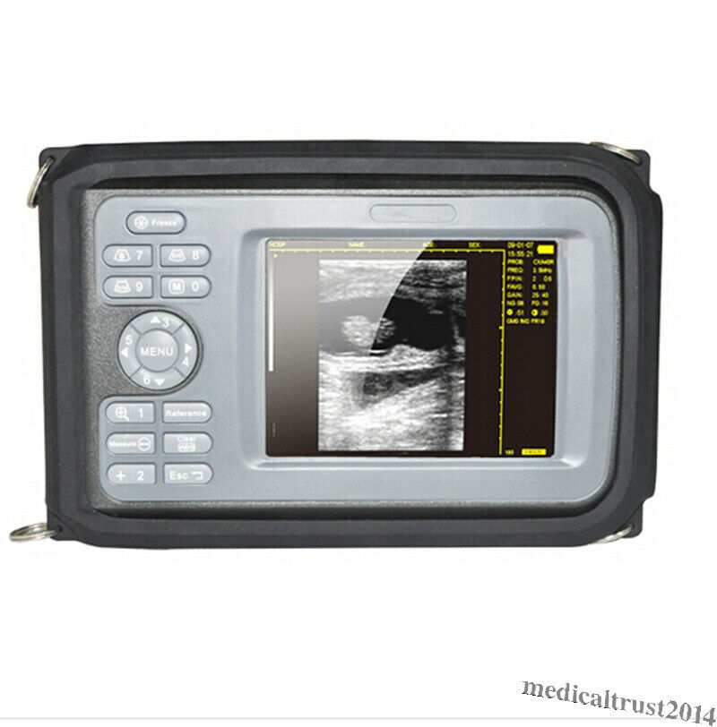 Portable Digital Handheld Human Ultrasound Scanner Machine 3.5mhz Convex Probe DIAGNOSTIC ULTRASOUND MACHINES FOR SALE