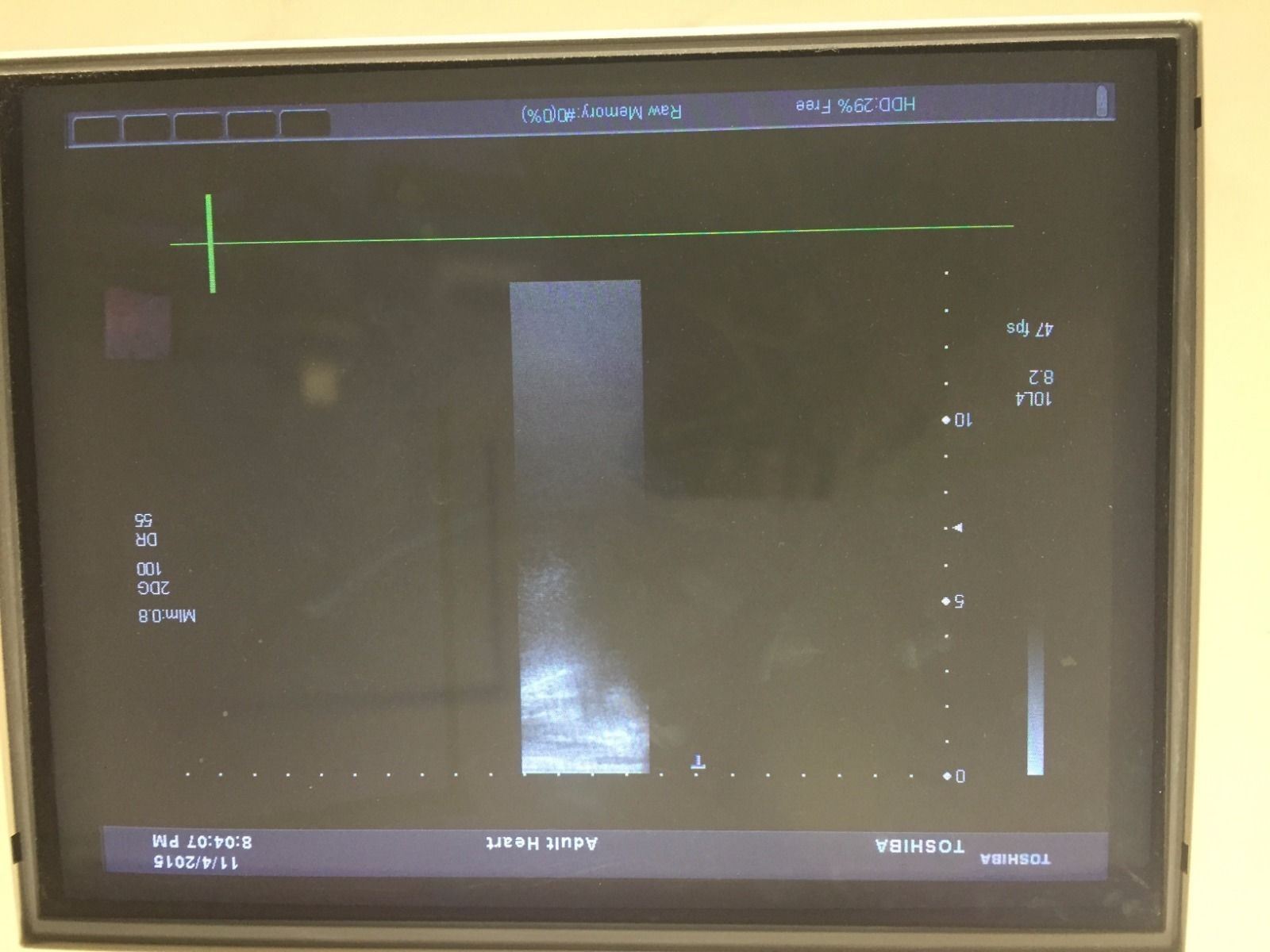 Toshiba Aplio 500 PLT-604AT 6MHz Linear Array Ultrasound Transducer Probe DIAGNOSTIC ULTRASOUND MACHINES FOR SALE