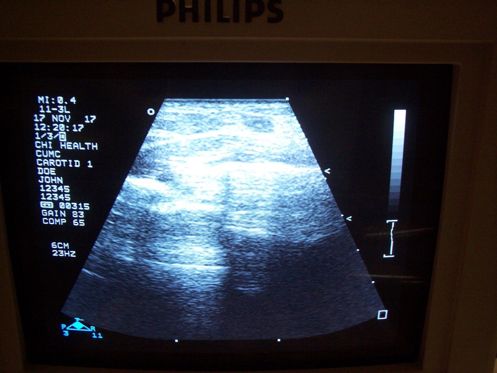 Philips Sonos 5500 M2424A Ultrasound with Probes