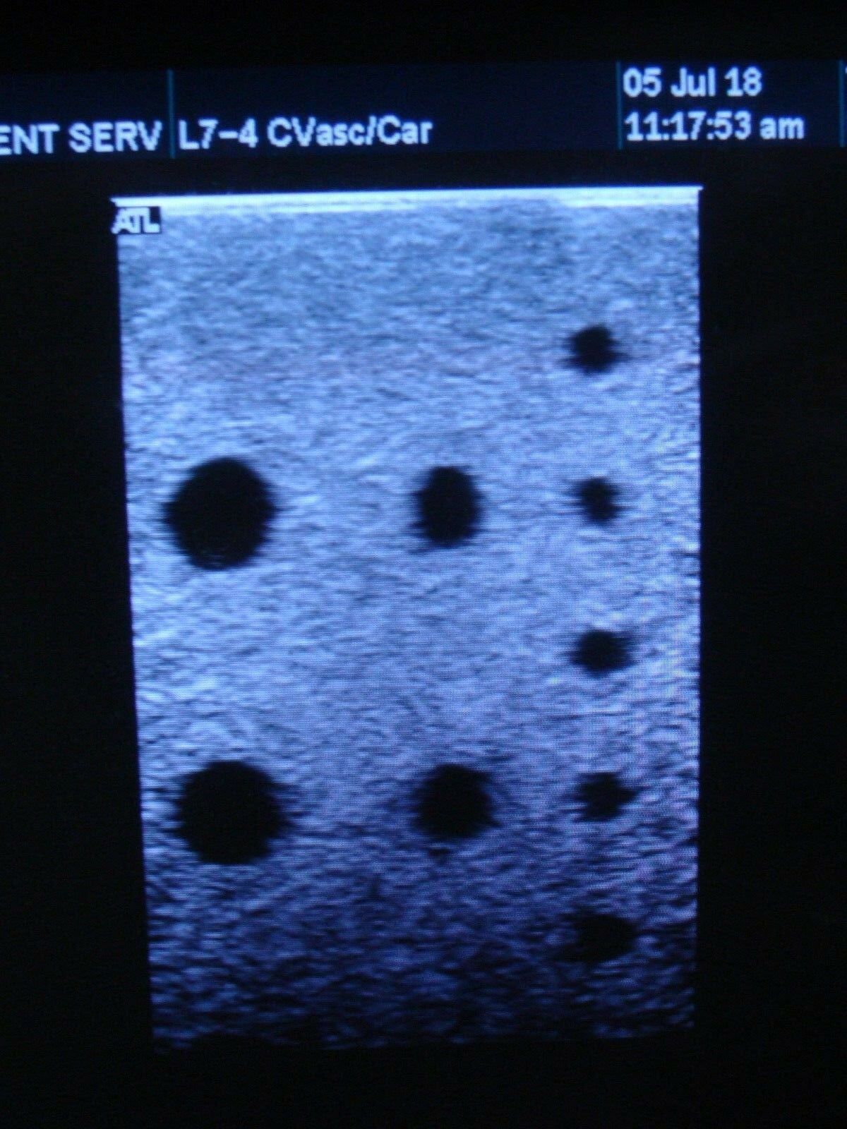 L7-4 LINEAR ARRAY TRANSDUCER PROBE FOR ATL HDI 5000 SONOCT ULTRASOUND SYSTEM DIAGNOSTIC ULTRASOUND MACHINES FOR SALE