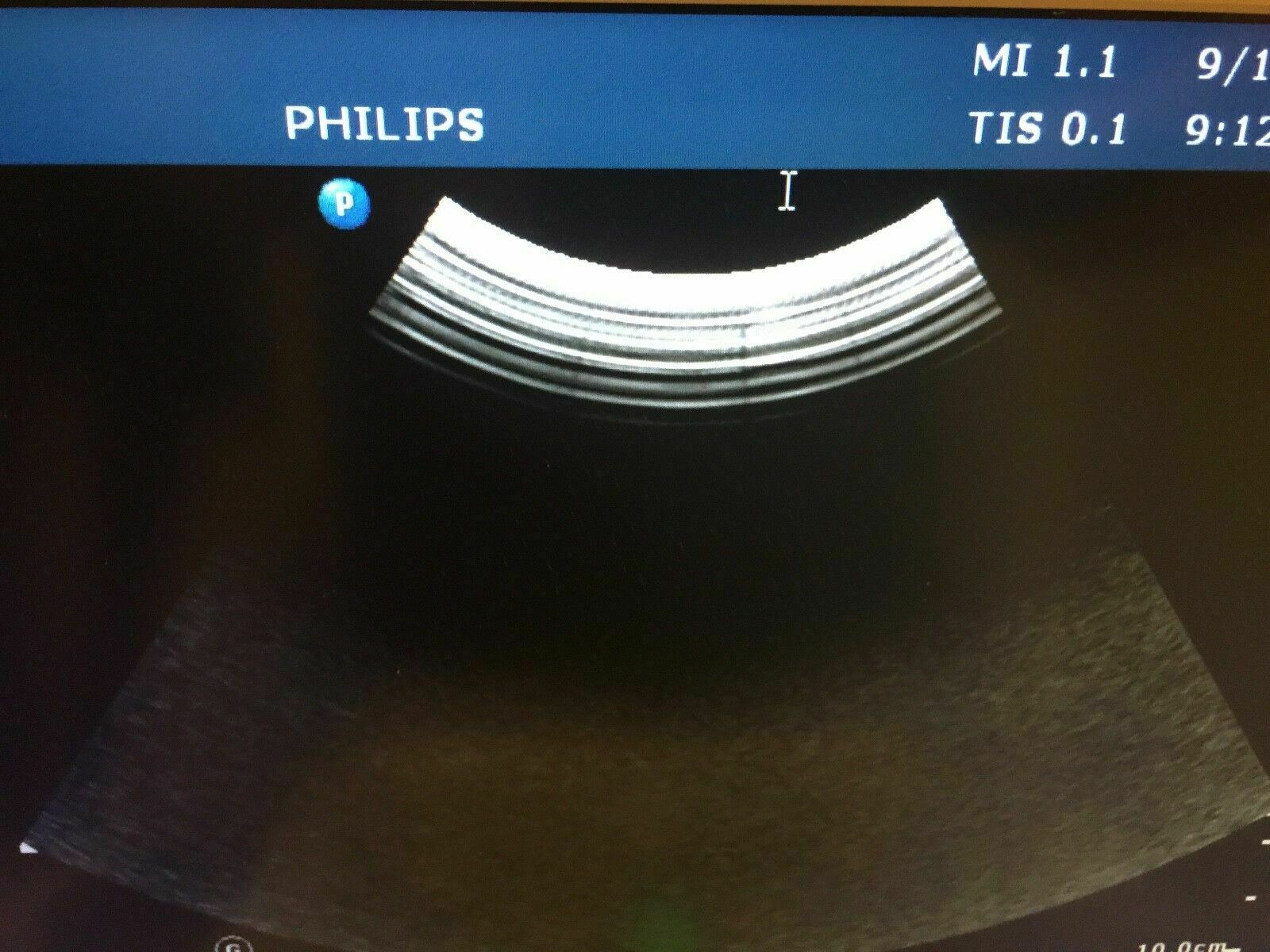 Philips CX-50 C5-1 Curved Abdominal Transducer Probe. Ultrasound Probe DIAGNOSTIC ULTRASOUND MACHINES FOR SALE