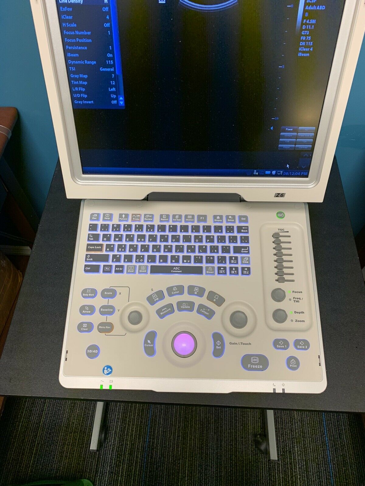 MINDRAY Z6  Portable Ultrasound Machine DIAGNOSTIC ULTRASOUND MACHINES FOR SALE