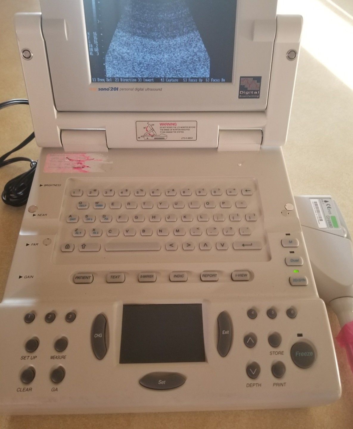 Medison mysono 201 Samsung Personal Digital Ultrasound With Probe DIAGNOSTIC ULTRASOUND MACHINES FOR SALE