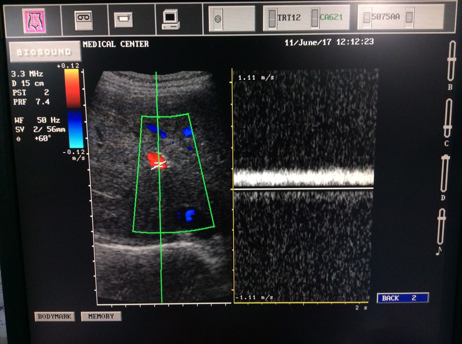 Esaote Biosound Megas/ MyLab ultrasound CA621 Convex probe DIAGNOSTIC ULTRASOUND MACHINES FOR SALE