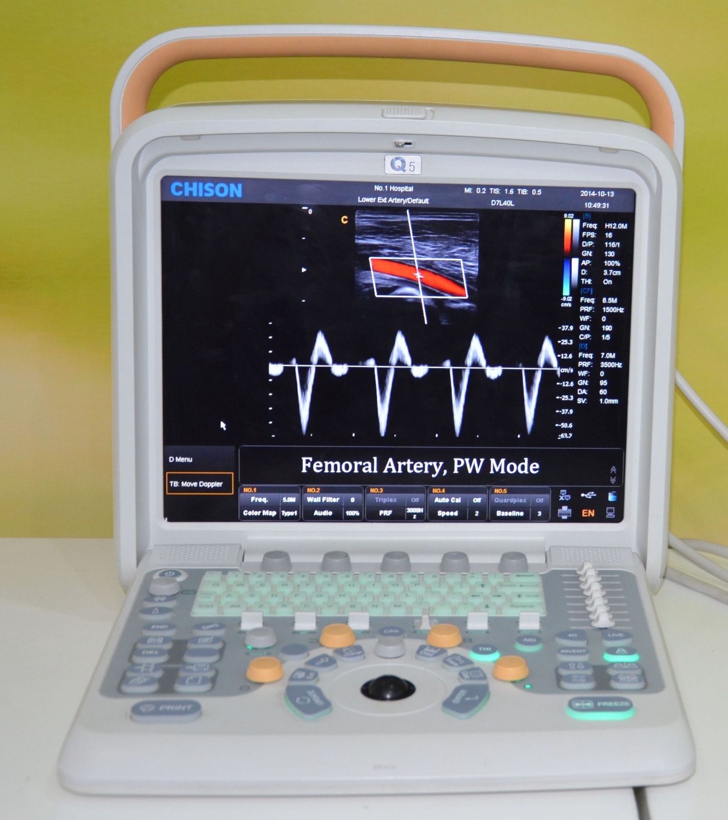 Color Doppler Ultrasound Chison Q5 with Trolley, and Linear Array Probe 5-10Mhz DIAGNOSTIC ULTRASOUND MACHINES FOR SALE