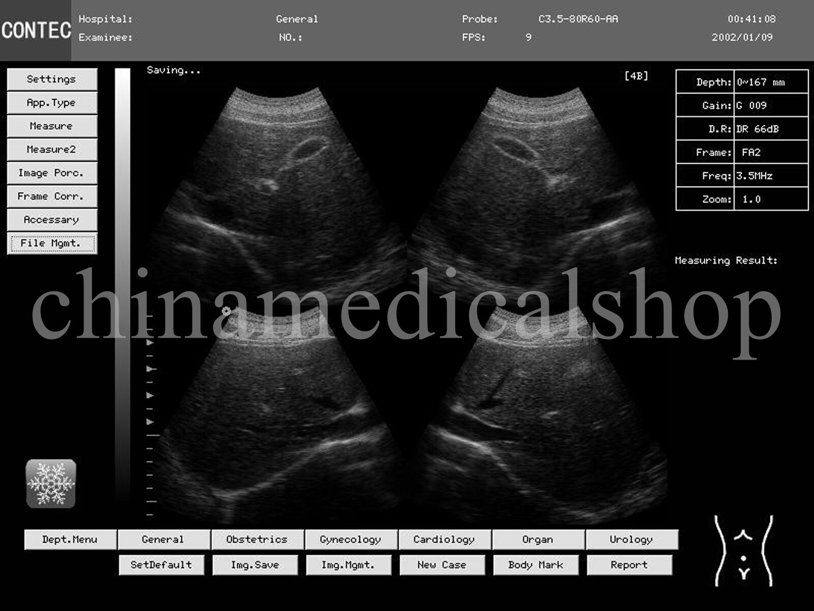 Portable Laptop Ultrasound Scanner Machine 2 Probes Digital Diagnostic System 658126901772 DIAGNOSTIC ULTRASOUND MACHINES FOR SALE