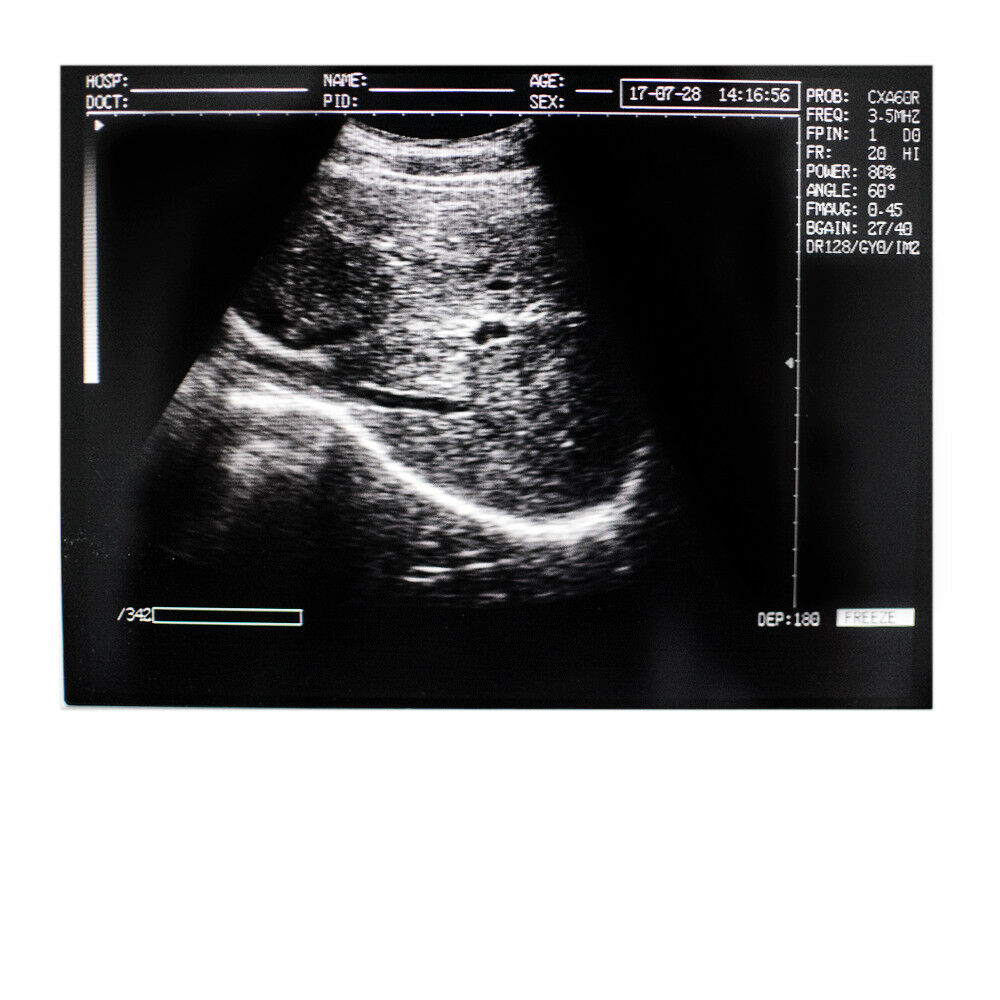 Notebook/Laptop Digital Ultrasound Scanner Convex/Abdominal Probe US STOCK DIAGNOSTIC ULTRASOUND MACHINES FOR SALE