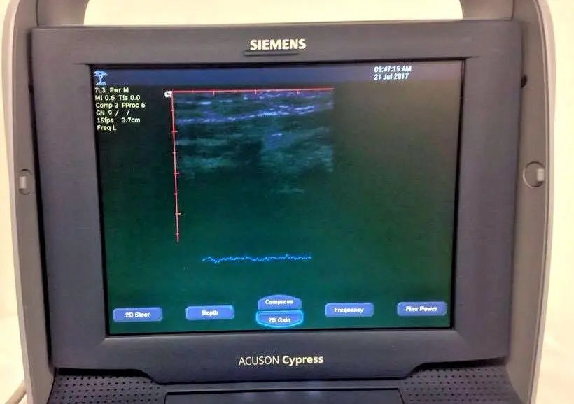 Siemens Acuson Plus Rev 20 Ultrasound Machine. BIOMED Certified. Echocardiogram DIAGNOSTIC ULTRASOUND MACHINES FOR SALE