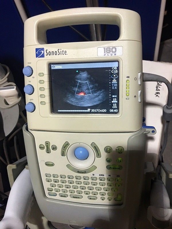 Sonosite 180 Plus ultrasound with docking unit aux. monitor and 2 Probes DIAGNOSTIC ULTRASOUND MACHINES FOR SALE