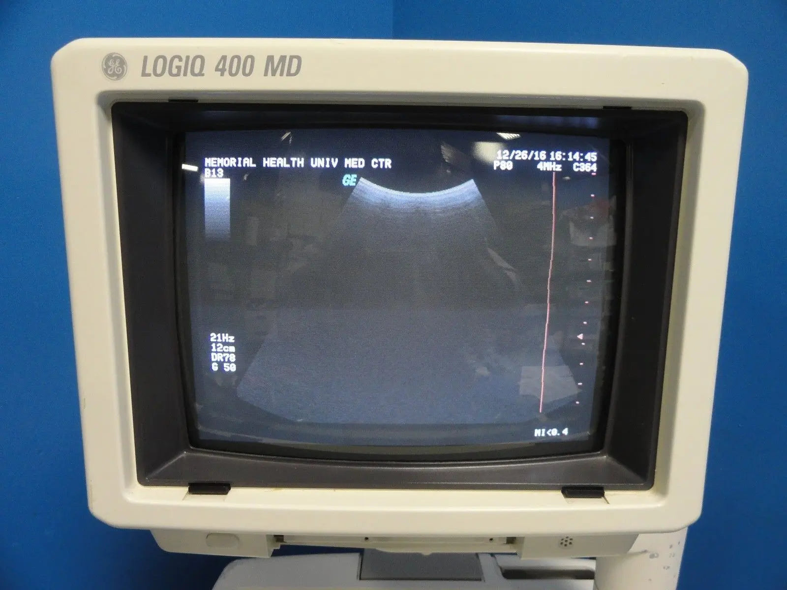 GE Logiq 400 MD Soft Pack Ultrasound W/ C364, C551, 739L  Probes & Printer~12413 DIAGNOSTIC ULTRASOUND MACHINES FOR SALE