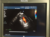 Philips IE33 Cardiovascular Ultrasound System with S5-1,L9-3, and S7-2Omni Probe 33100005132