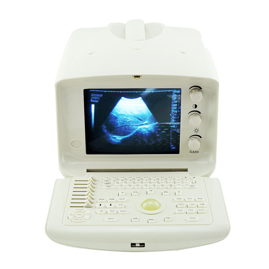 Medical Ultrasound Scanner Machine System CE, Convex + Transvaginal 2 Probe 3D 190891052773 DIAGNOSTIC ULTRASOUND MACHINES FOR SALE