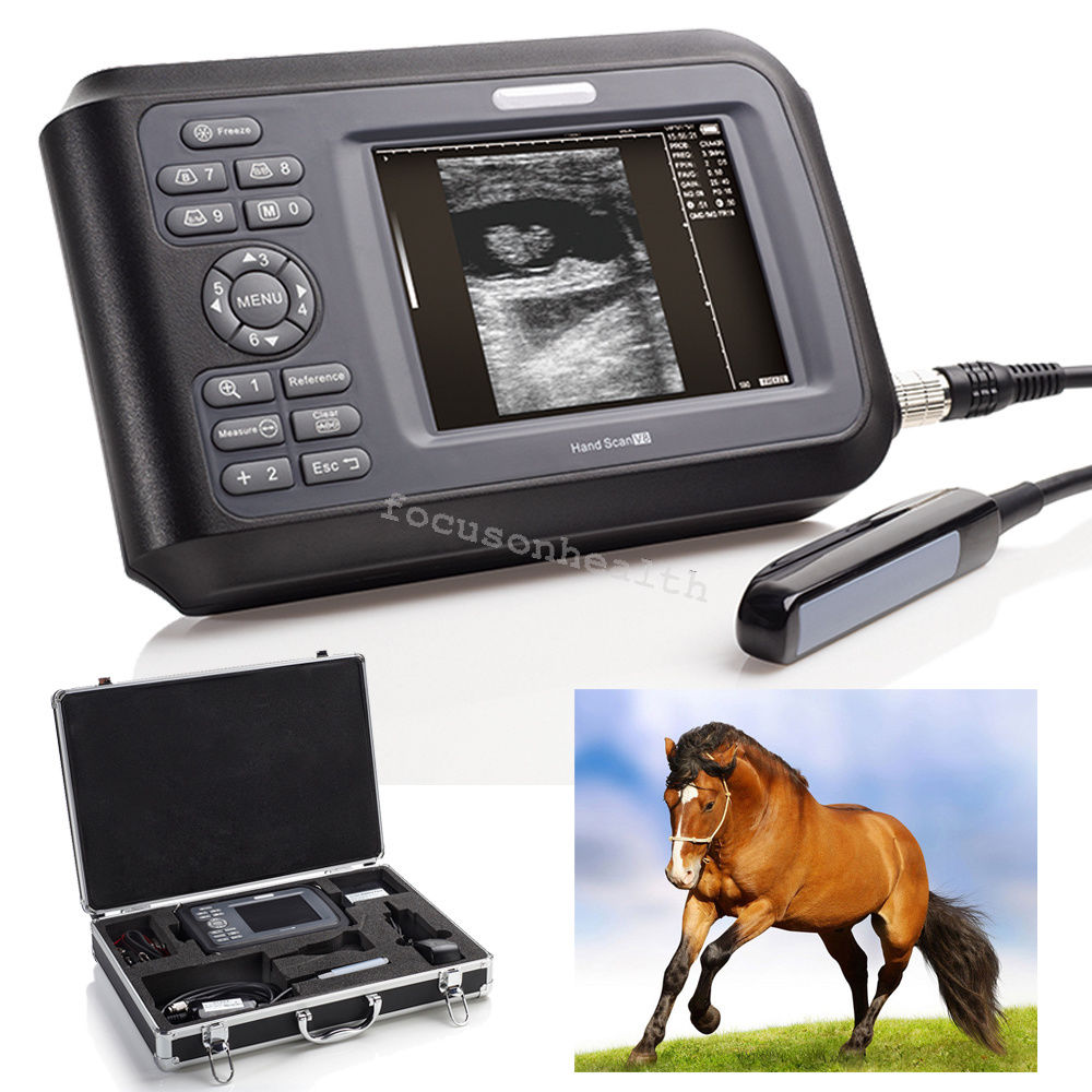 Vet Portable 64Cases Digital Ultrasound Scanner Monitor with Rectal Probe USA DIAGNOSTIC ULTRASOUND MACHINES FOR SALE