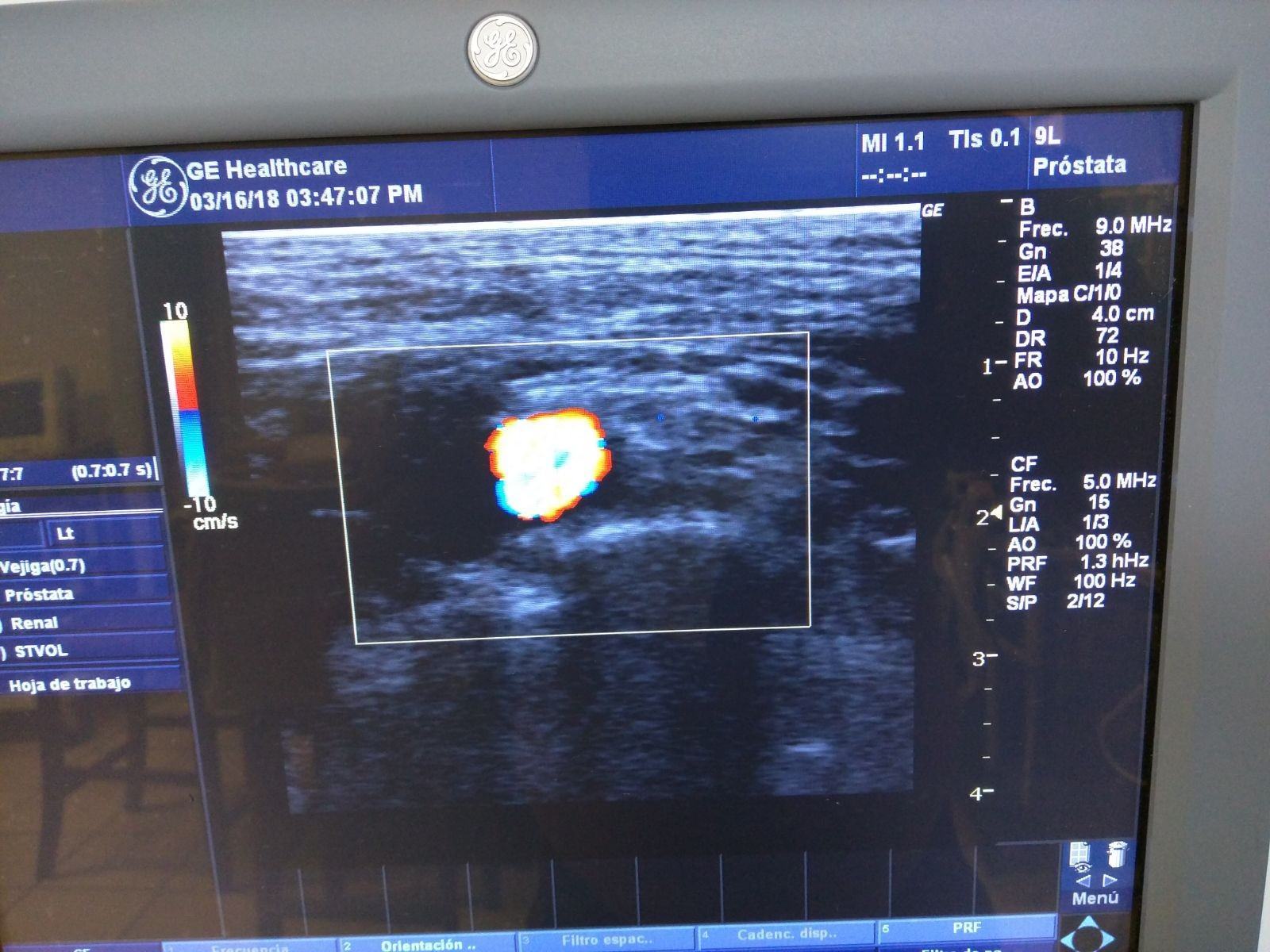 GE LOGIQ P5 2007 ULTRASOUND SYSTEM W/3 PROBES 4C CONVEX & 9L LINEAR & E8C TRANSV DIAGNOSTIC ULTRASOUND MACHINES FOR SALE