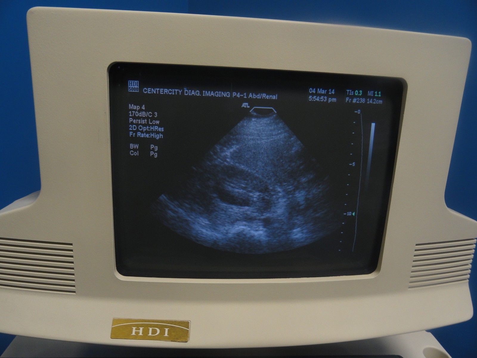 a monitor with a picture of a breast on it