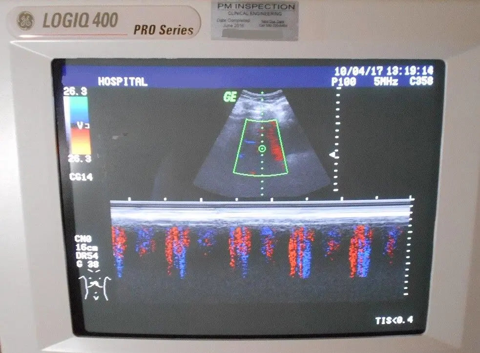 General Electric Logiq 400 2264468 Pro Series Ultrasound w/ Probes E721-C358-LA3 DIAGNOSTIC ULTRASOUND MACHINES FOR SALE