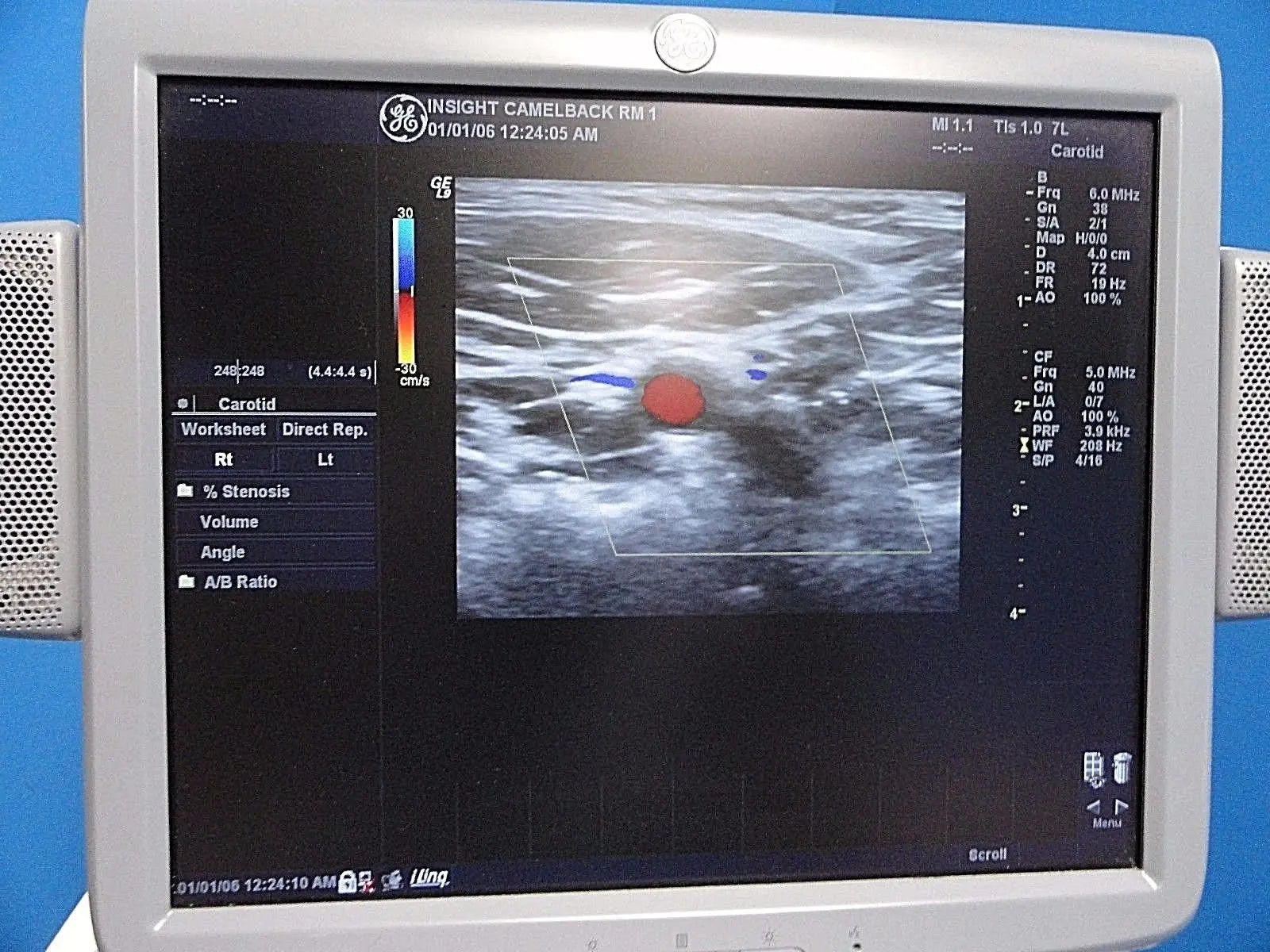 GE  7L / 2302648 Linear Array Ultrasound Probe for Logiq & Vivid Series~13787 DIAGNOSTIC ULTRASOUND MACHINES FOR SALE