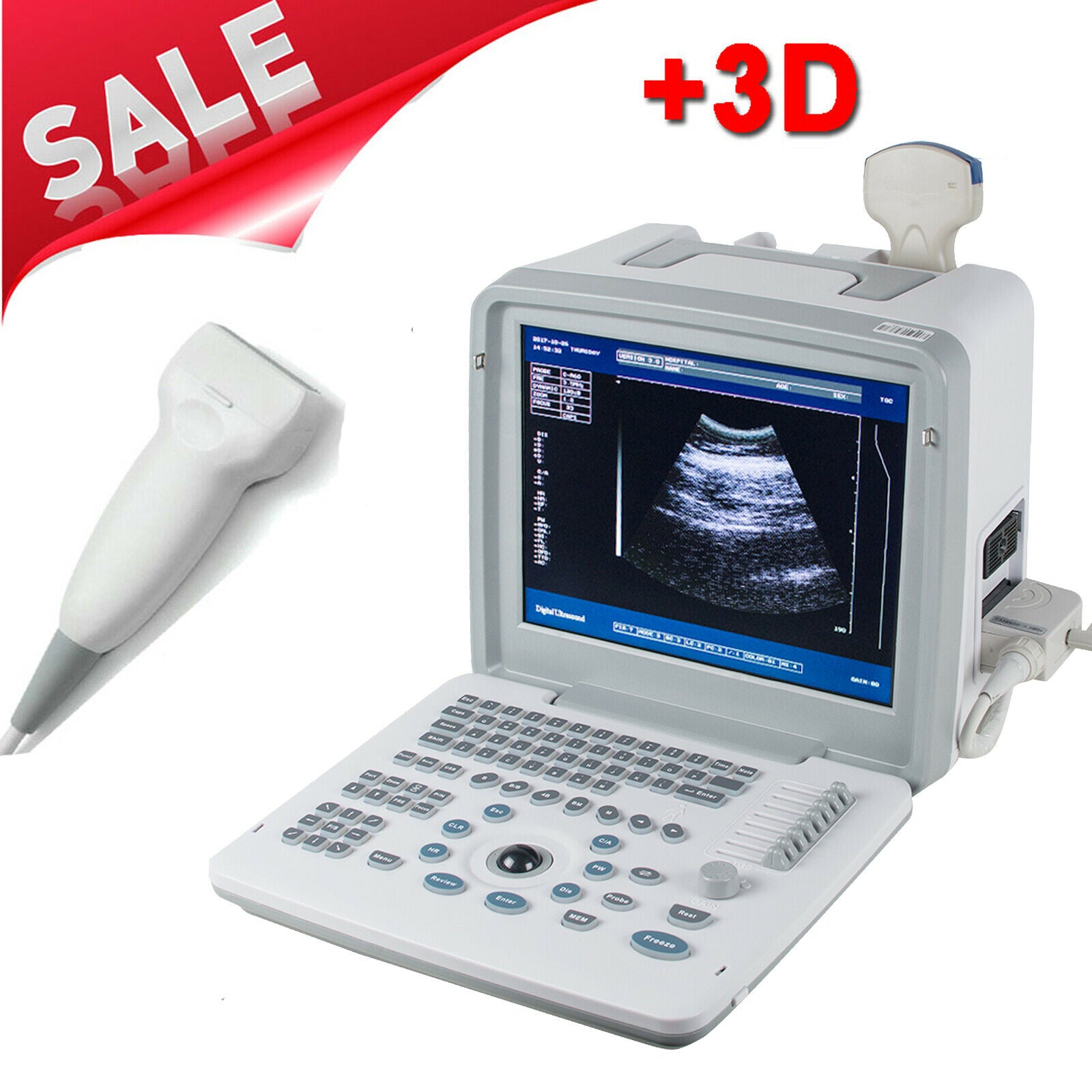 LCD Full Digital Portable Ultrasound Scanner Machine Convex Linear 2 Probes + 3D DIAGNOSTIC ULTRASOUND MACHINES FOR SALE