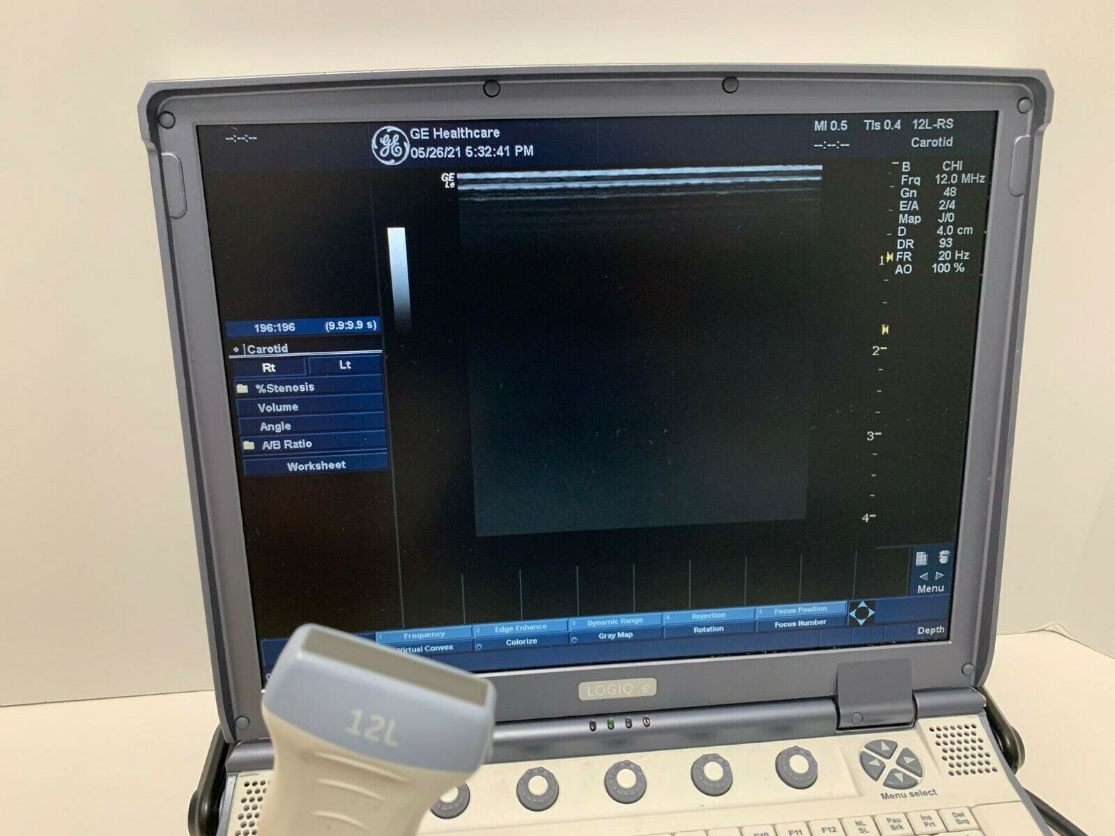 GE Logiq e Portable Ultrasound Machine System With 12L-RS DIAGNOSTIC ULTRASOUND MACHINES FOR SALE