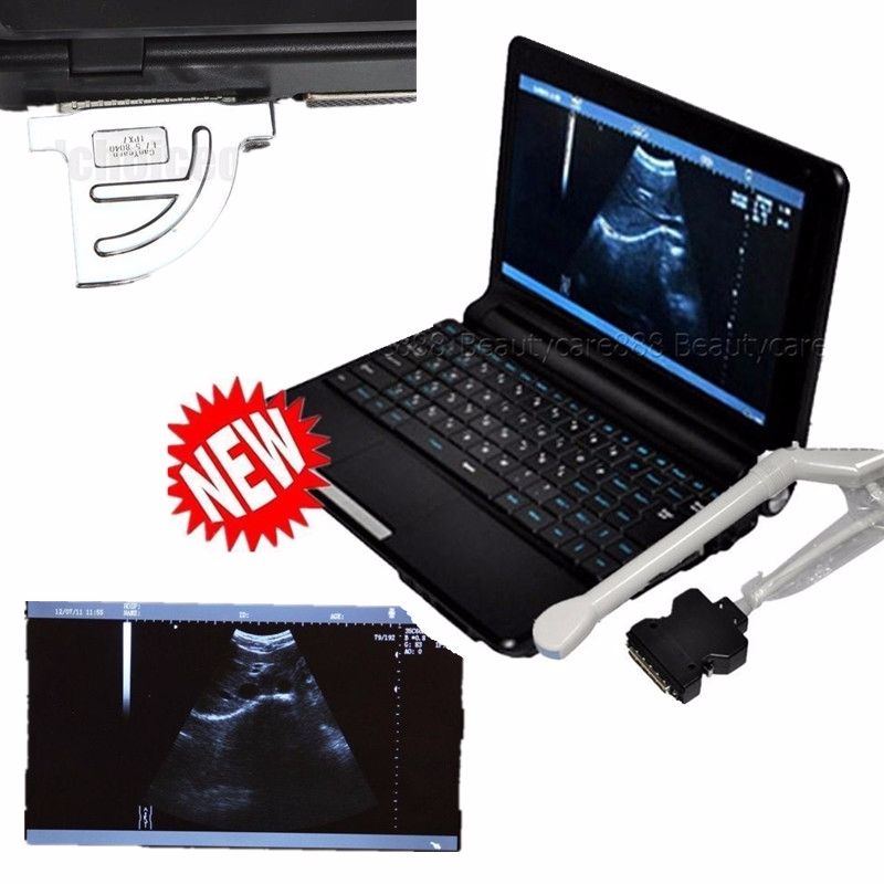 Fast Notebook Laptop Ultrasound Scanner Machine 6.5 MHZ Transvaginal Probe + 3D DIAGNOSTIC ULTRASOUND MACHINES FOR SALE