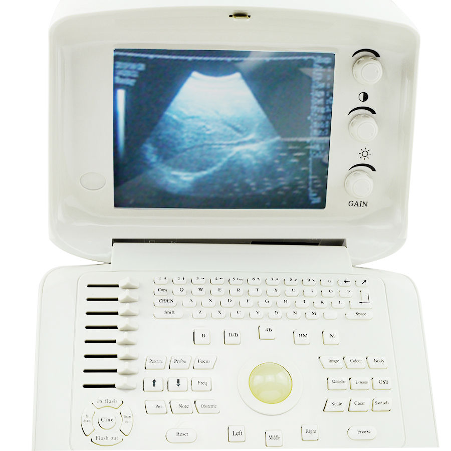 2 Probes Full Digital Ultrasound Machine Scanner Transvaginal+ Linear Probe AAA DIAGNOSTIC ULTRASOUND MACHINES FOR SALE