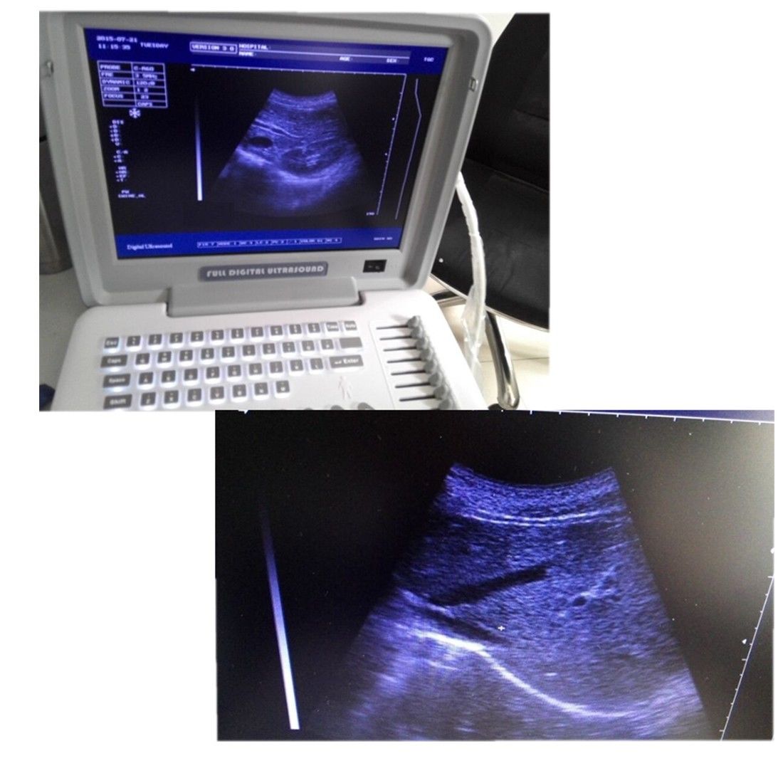 High Clear 3D LED 12 Inch Laptop Machine Ultrasound Scanner CONVEX+LINEAR Probe 190891304322 DIAGNOSTIC ULTRASOUND MACHINES FOR SALE
