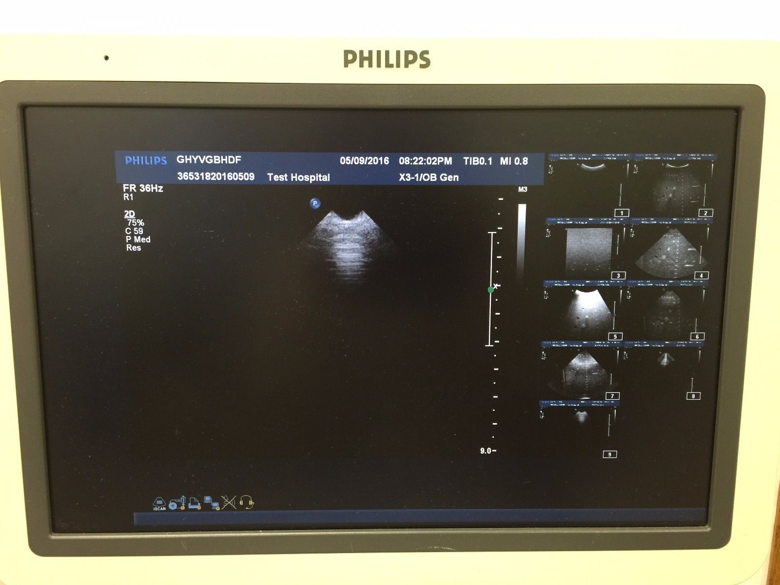 Philips x3-1 Ultrasound Transducer for Philips iE33 Ultrasound System