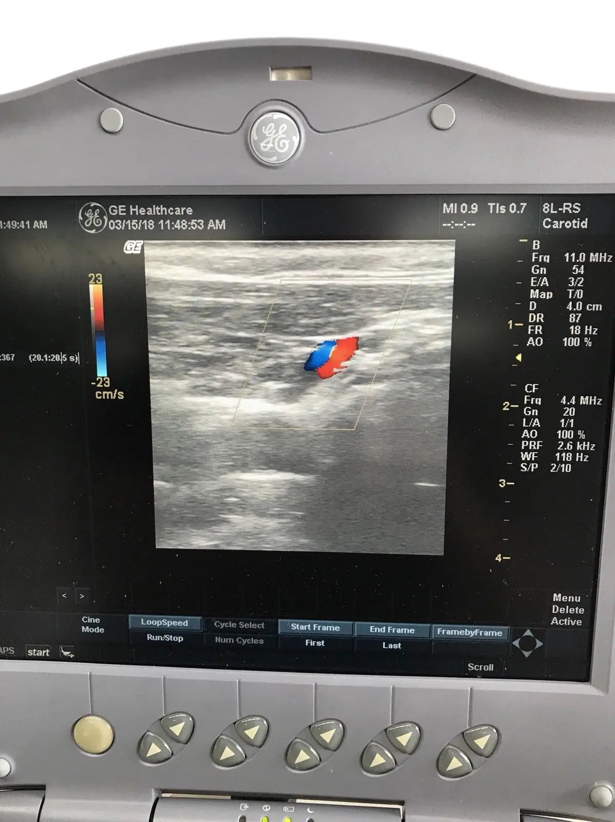 GE Logiq Book XP with 2 x Ultrasound Probes. Linear and Convex 2011 DIAGNOSTIC ULTRASOUND MACHINES FOR SALE