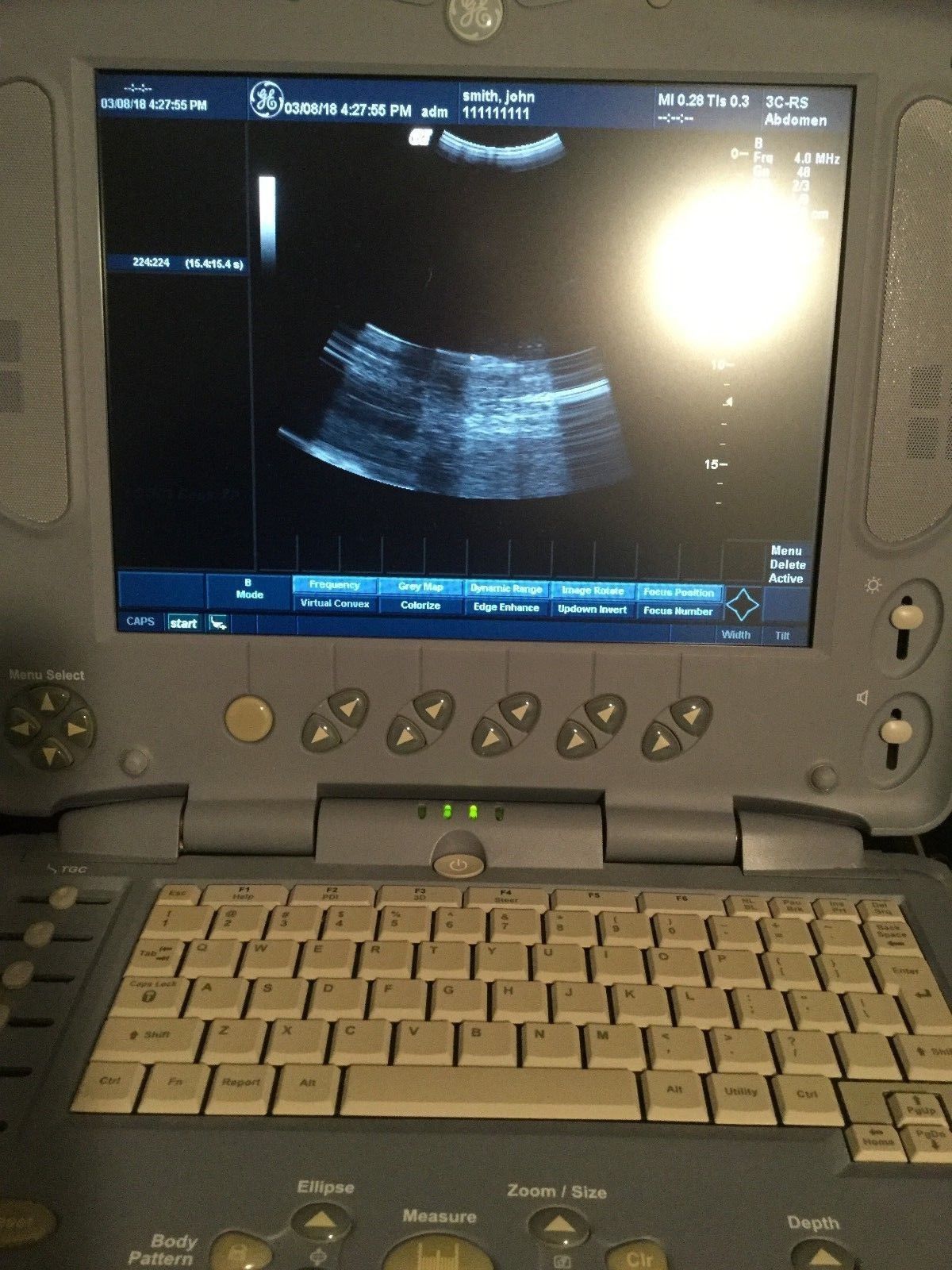 a laptop ultrasound sitting on top of a desk