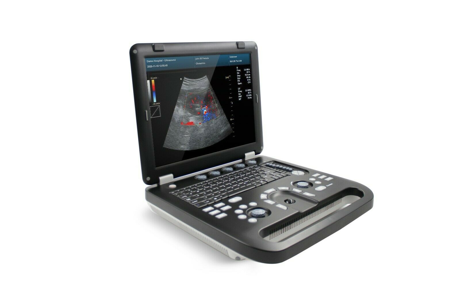 Color Doppler Ultrasound Scanner Cardiac Machine + Phased Array Probe Heart Exam DIAGNOSTIC ULTRASOUND MACHINES FOR SALE