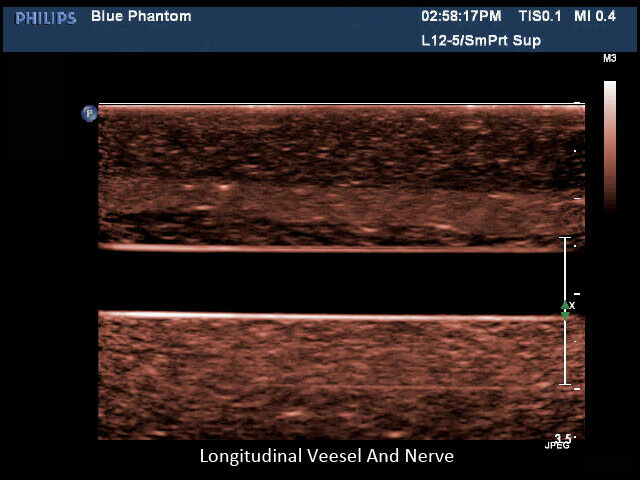 Regional Anesthesia Ultrasound Training Block Model DIAGNOSTIC ULTRASOUND MACHINES FOR SALE