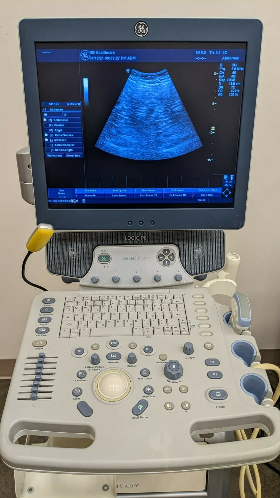 GE LOGIQ P6 W/2 PROBES ULTRASOUND SYSTEM DIAGNOSTIC ULTRASOUND MACHINES FOR SALE